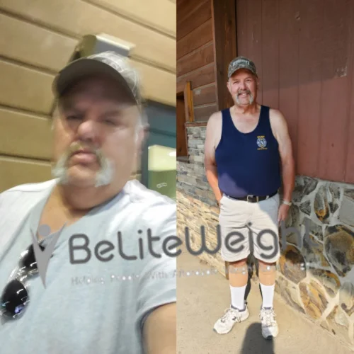 Adam C - 1 Year Update*
